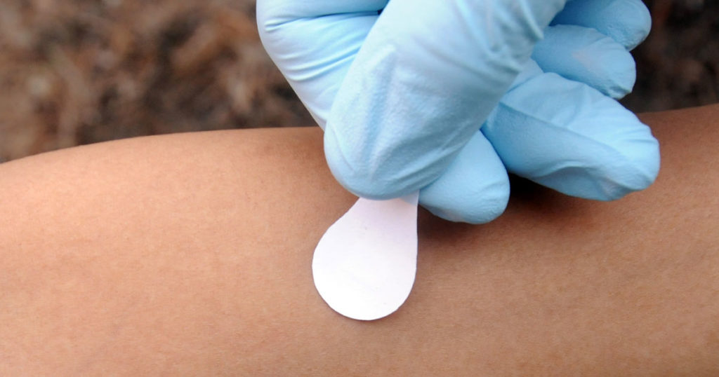 Microneedle patch being used