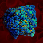 HIV-infected cell